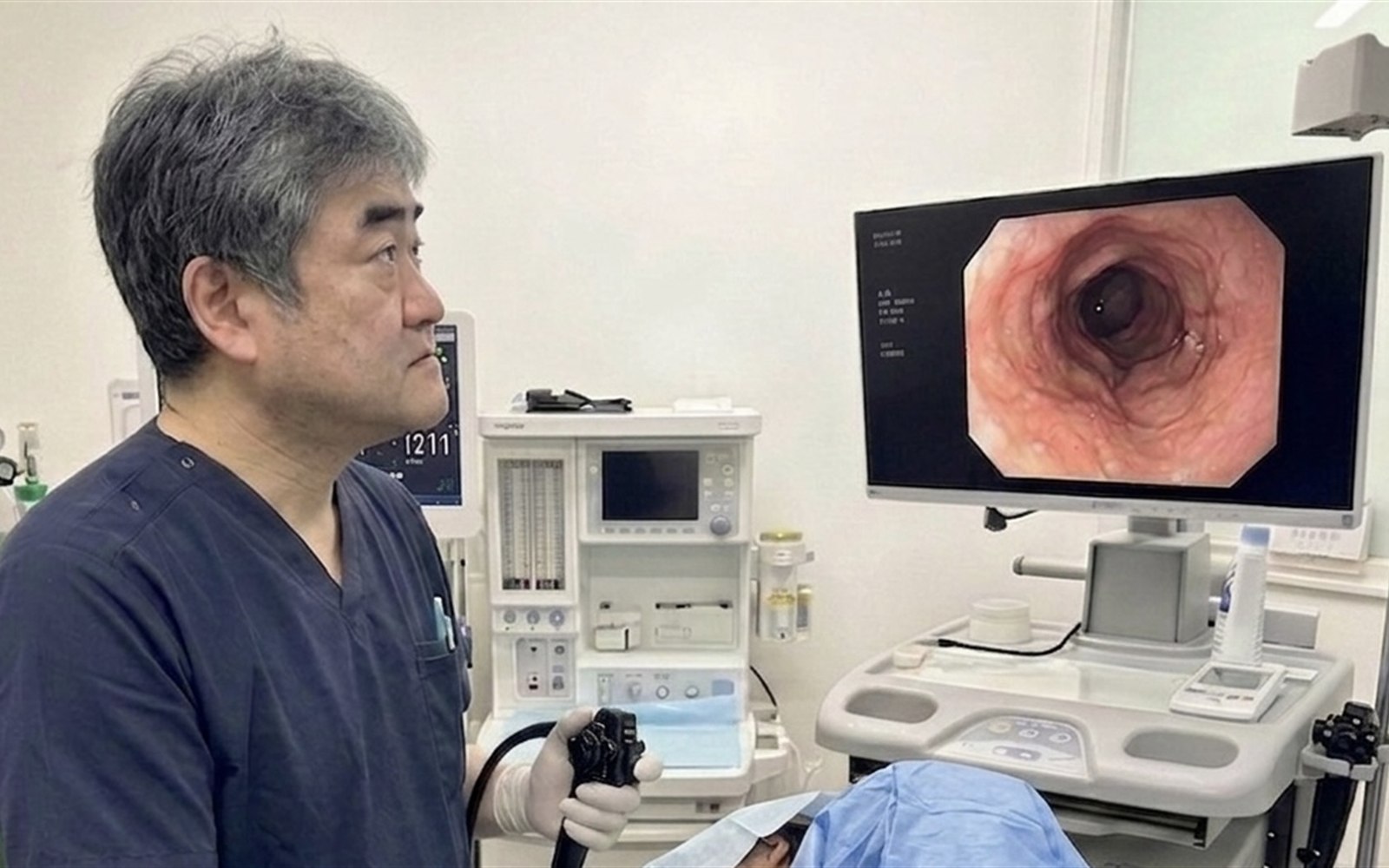 内視鏡検査機器のイメージ
